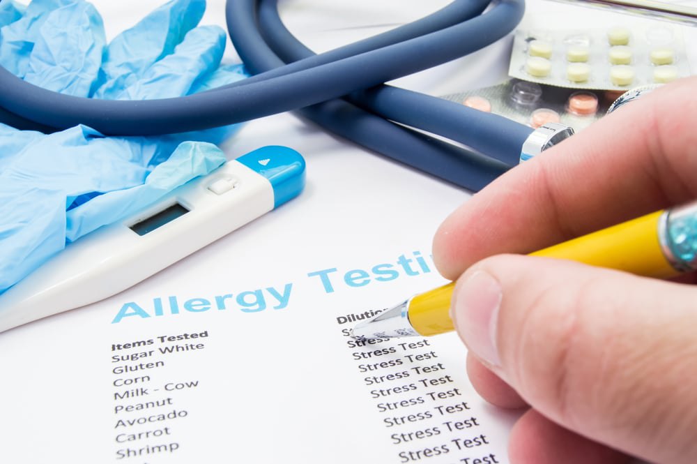 houston allergist and allergies