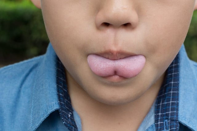 tongue tied.jpg