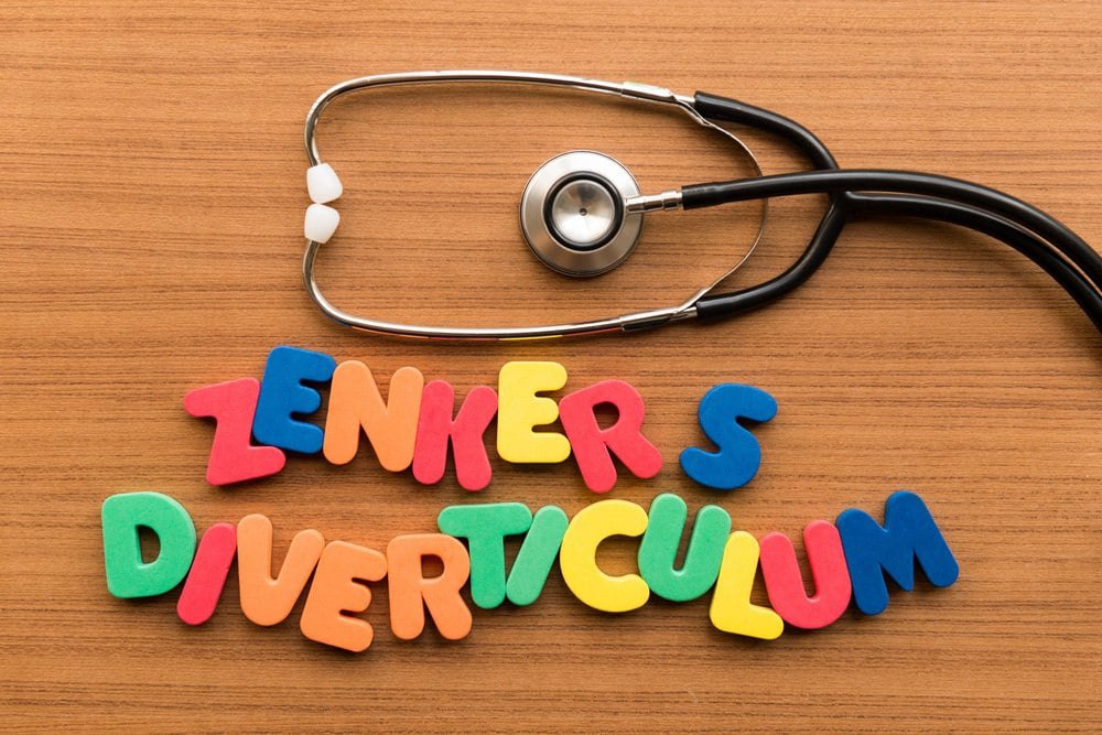 what is zenkers diverticulum