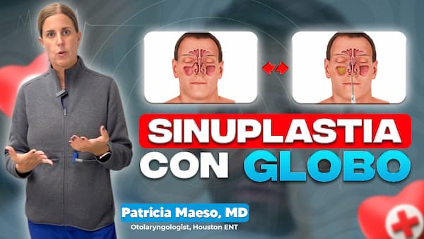 balloon sinuplasty