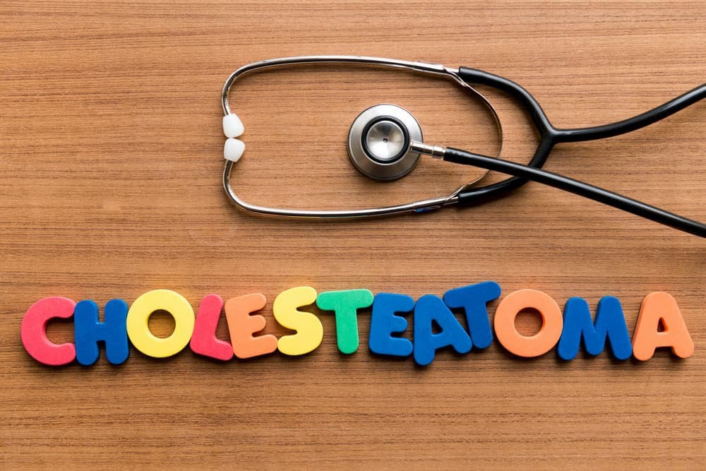 CHOLESTEATOMA signs symptoms definition and treatment options houston texas