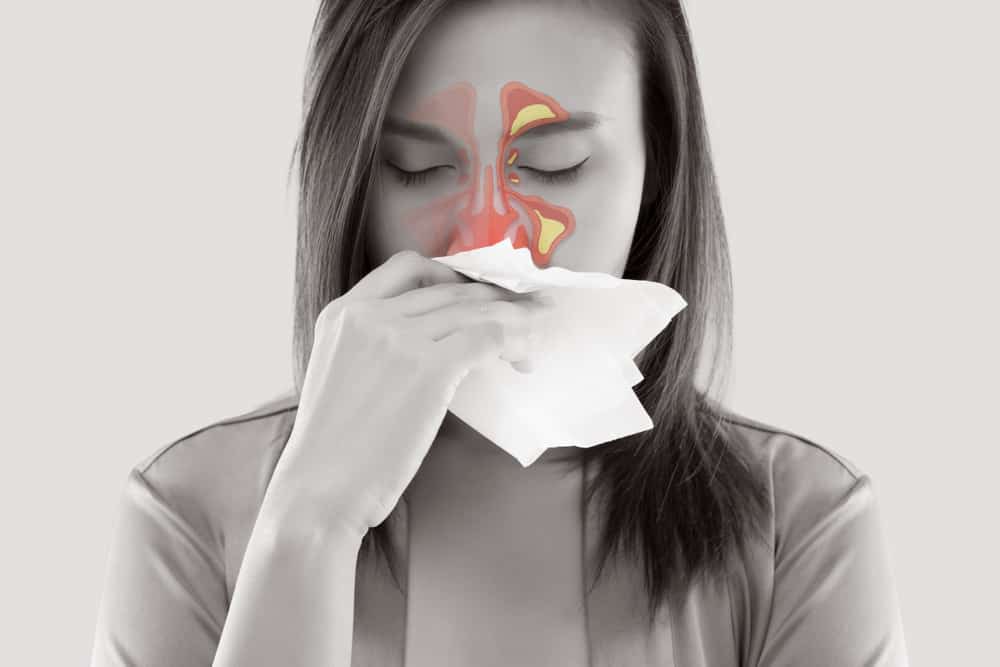 Sinus Headache Signs Symptoms And Treatment Options