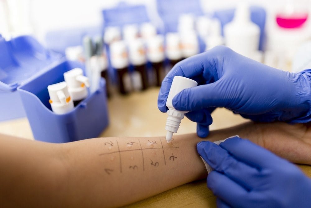 skin allergy tests in houston