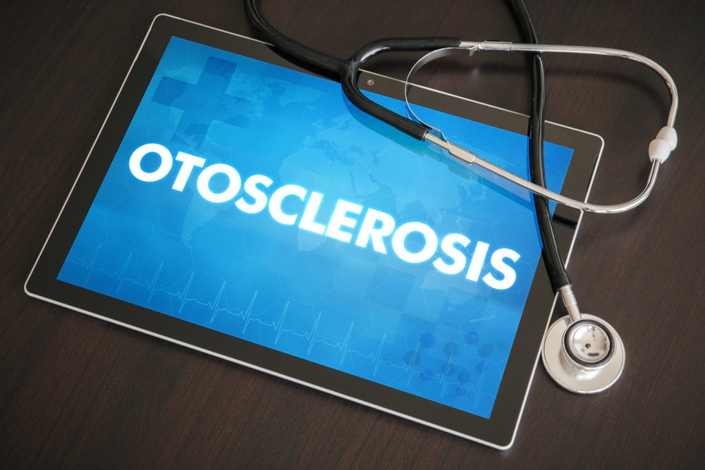 what is OTOSCLEROSIS houston texas